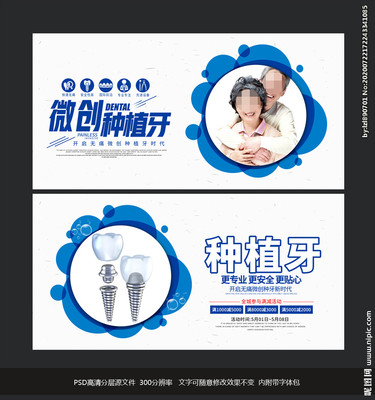 種植牙設計圖 精準美學與高效傳播的交匯點